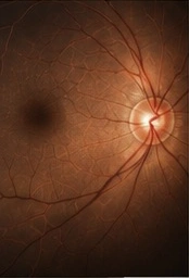 Warm-toned retinal fundus image